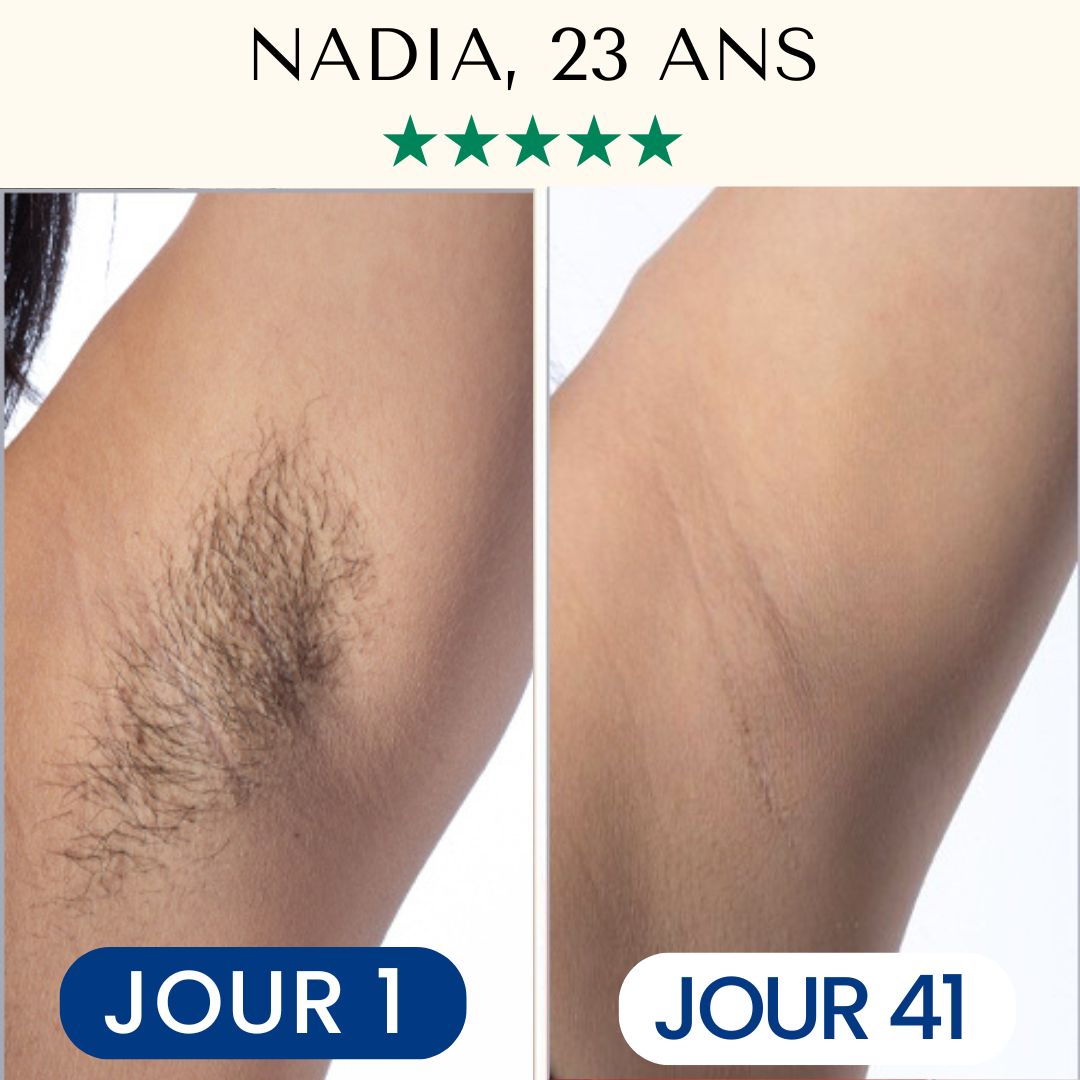 Épilateur Lumière Pulsée IPL™