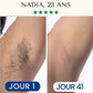 Épilation Définitive Professionnelle à la Lumière Pulsée IPL™