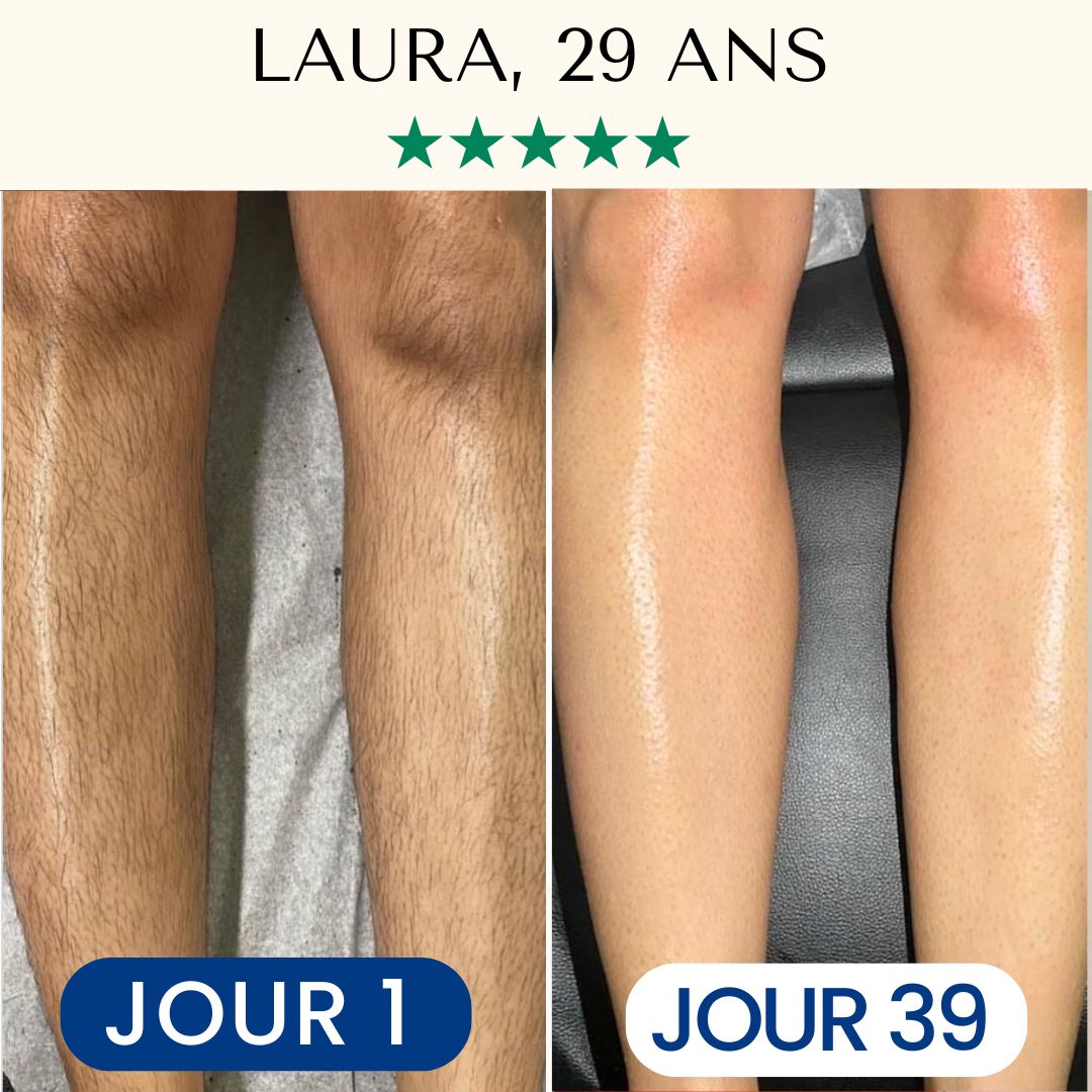 Épilateur Lumière Pulsée IPL™