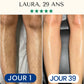 Épilation Définitive Professionnelle à la Lumière Pulsée IPL™