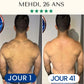 Épilation Définitive Professionnelle Lumière Pulsée IPL™ pour Homme