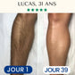 Épilation Définitive Professionnelle Lumière Pulsée IPL™ pour Homme