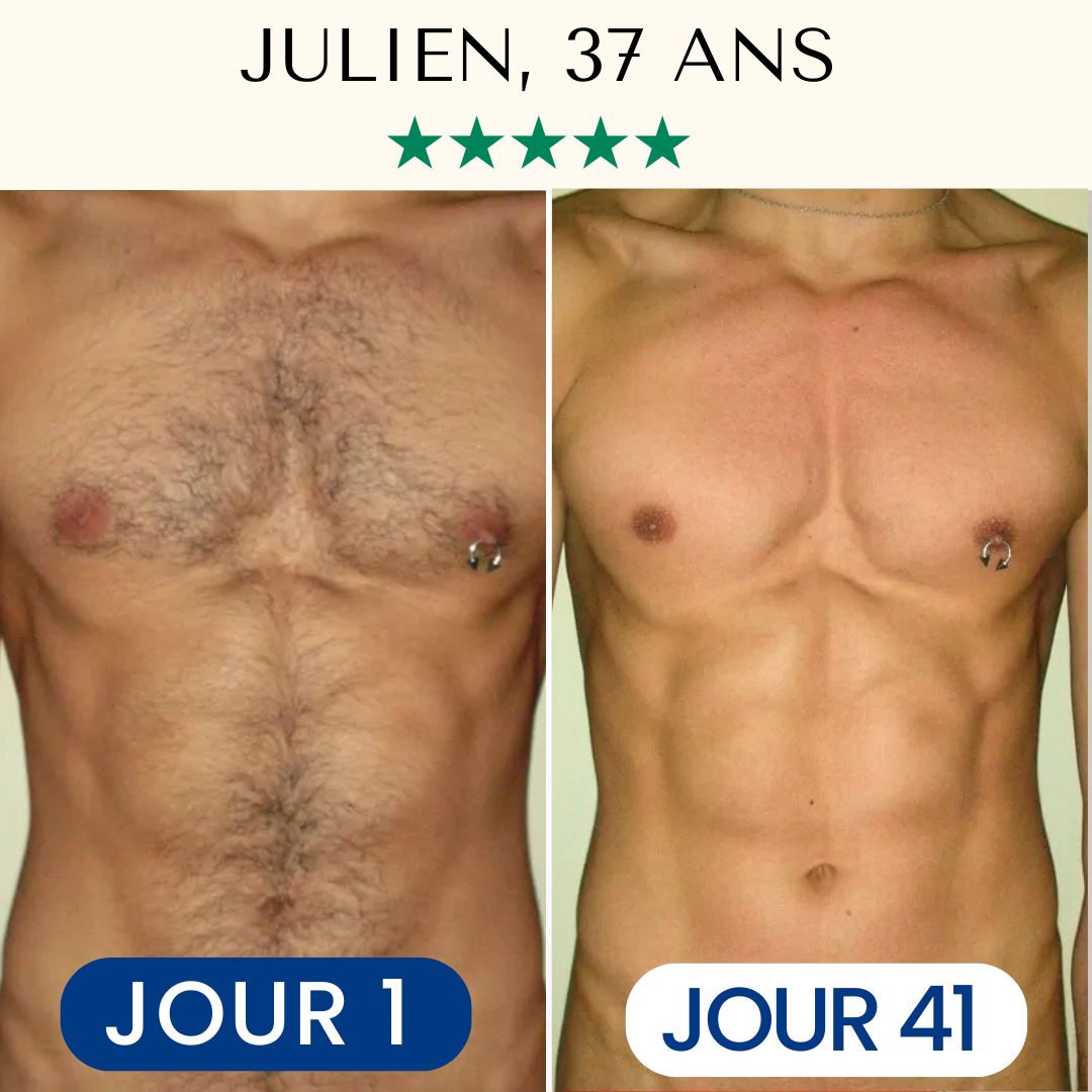 Épilation Définitive Professionnelle Lumière Pulsée IPL™ pour Homme