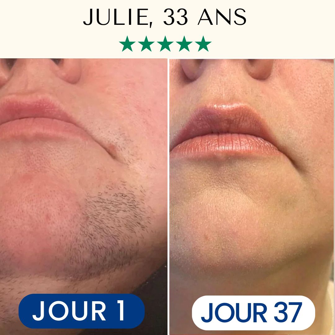 Épilateur Lumière Pulsée IPL™