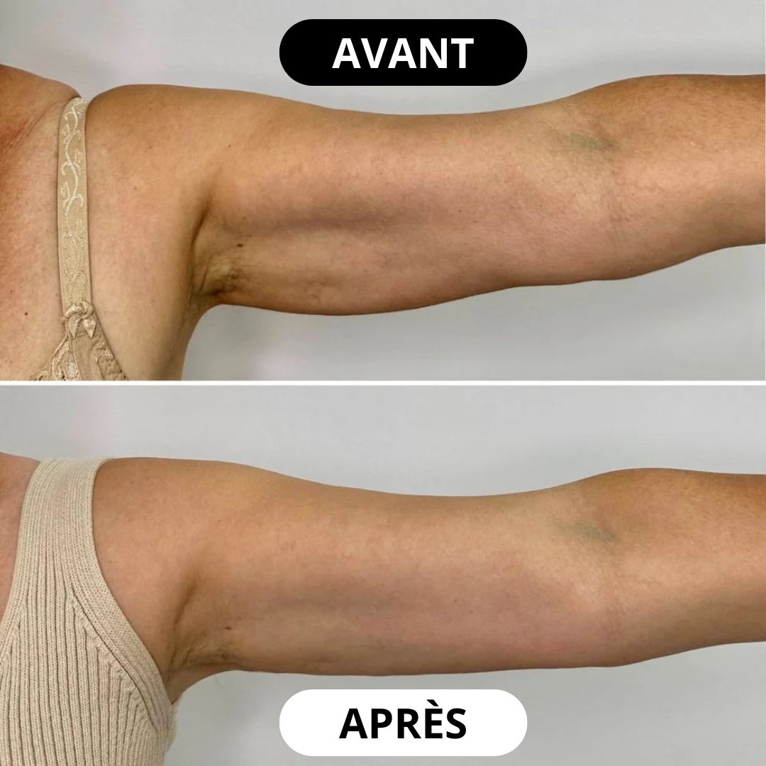 Démonstration produit