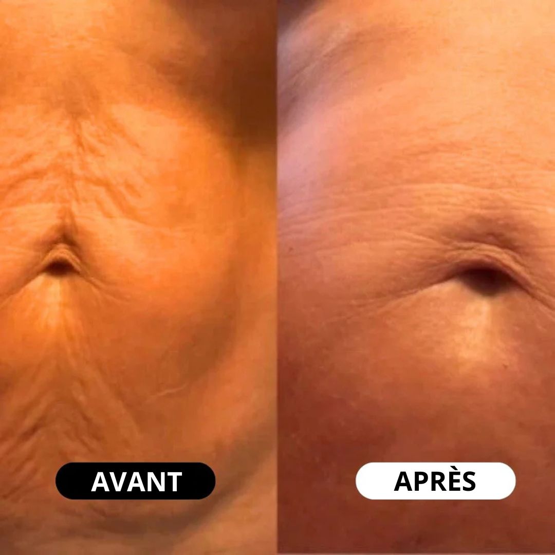 Huile Liftante Anti-Rides Corps